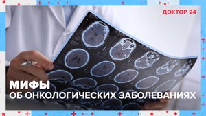 МИФЫ об ОНКОЛОГИЧЕСКИХ заболеваниях | Доктор 24