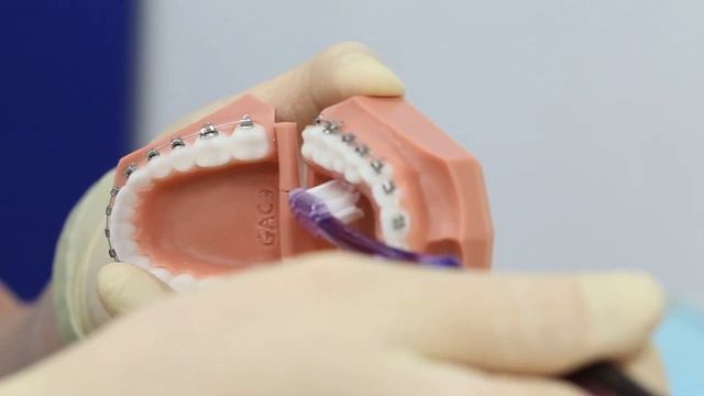Чистка зубов с брекетами. Часть 1 смотреть онлайн