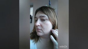 10 курс электроэпиляции лица
