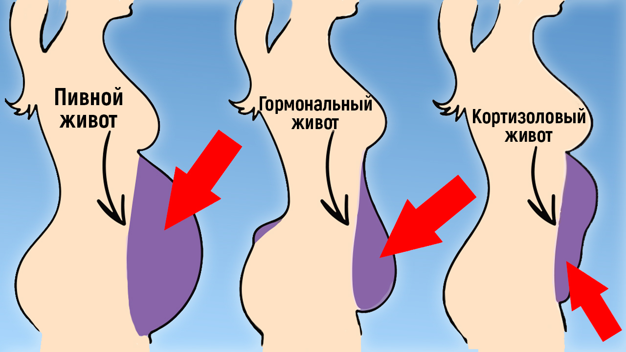Это заставляет нас ТОЛСТЕТЬ и ТЕРЯТЬ ПАМЯТЬ! / Что за гормон КОРТИЗОЛ?