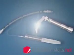 3D моделированная интубация трахеи