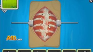 Operate Now: Scoliosis Surgery - walkthrough