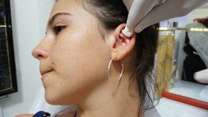 Rook & Tragus Piercing Deldirme