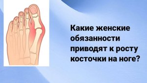 Как вылечить косточку на ноге?