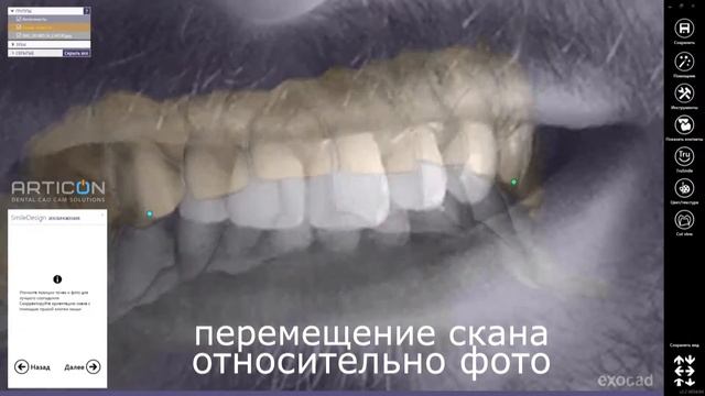 Exocad Дизайн улыбки смотреть онлайн