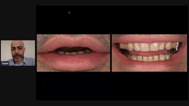 Онлайн марафон ZenAntiCovid. День 2 смотреть онлайн