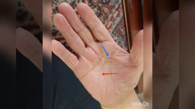 Как на ладони выглядит потеря памяти?