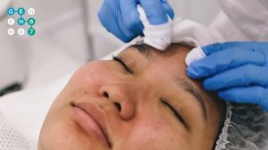 ЧИСТКА ЛИЦА У КОСМЕТОЛОГА Сеть клиник косметологии GEN87