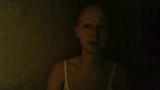 Выпуск 2. Алопеция. Принятие себя. смотреть онлайн