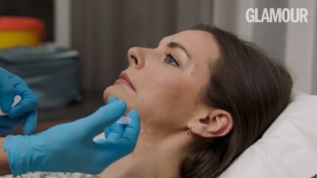 Extreme Glamour Tries: Botox Reviewed On Video | GLAMOUR UK смотреть онлайн