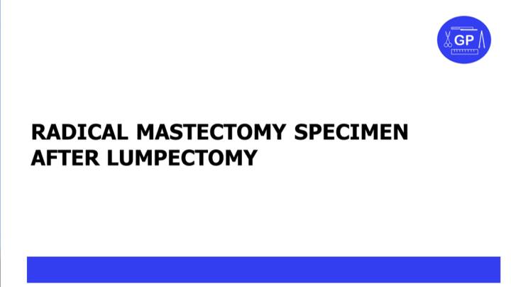 Radical mastectomy specimen after lumpectomy (pathology)
