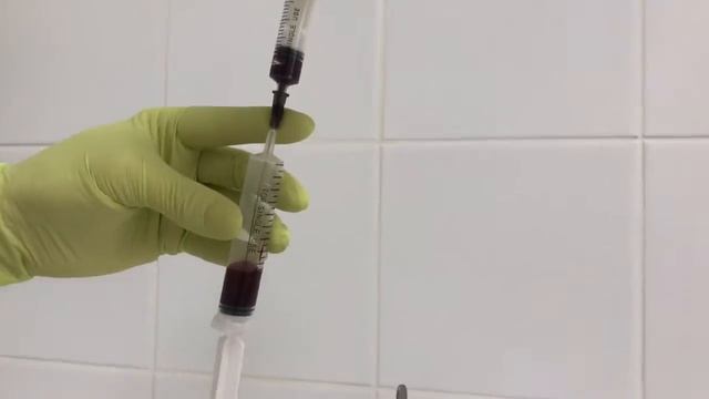 Аутогемотерапия смотреть онлайн