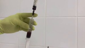Аутогемотерапия