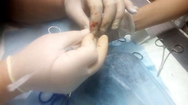 Хирургическое удаление дирофиляриоза у собак