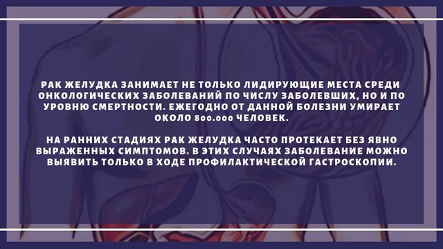 Группы риска по раку желудка смотреть онлайн
