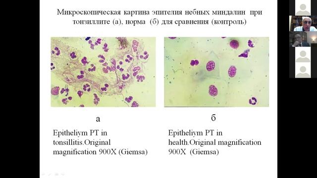 Кузнецов. "Небные миндалины как маркер эффективности воздействия природно-климатических факторов"