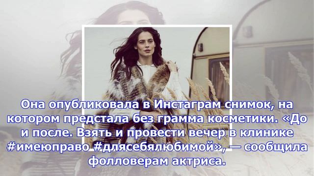 Юлия снигирь поделилась снимком, сделанным после похода к косметологу