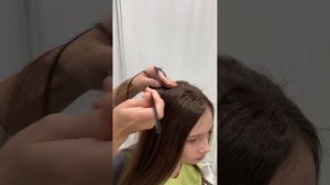 Детская алопеция..