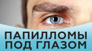 Удаление папиллом и микроатером под глазом