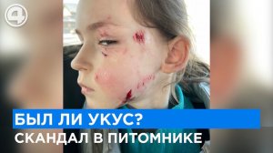 Кто вернет лицо ребенку. Нападение собак или жажда наживы?