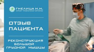 Разрыв большой грудной мышцы. 4 года после операции.