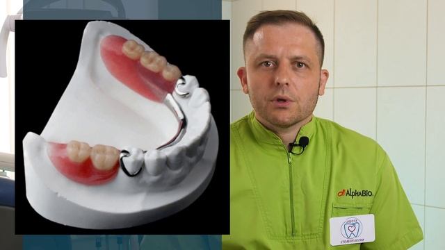 Бюгельные зубные протезы. Что это и для кого? Преимущества и недостатки.