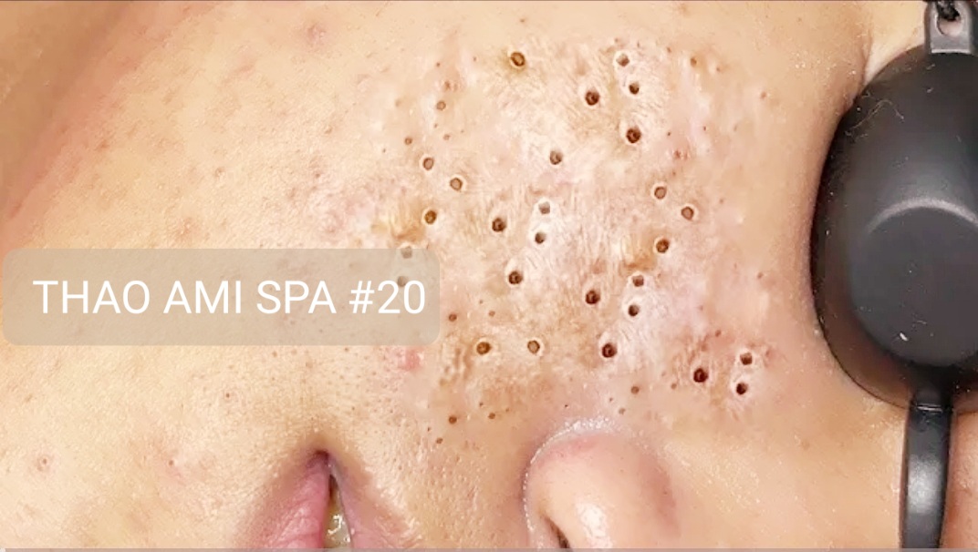 Enjoy Your Day with THAO AMI SPA # 121 смотреть онлайн