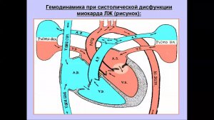 УЗД систолической дисфункции ЛЖ Моргунов М Н