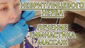 Что делать при неврите лицевого нерва!!!