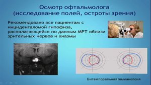 Астафьева Л.И. Диагностика и тактика ведения пациента с микроаденомой гипофиза