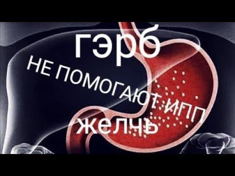 Почему не помогают ИПП. Скрытый желчный рефлюкс