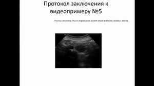Эхосемиотика структурных изменений поджелудочной железы