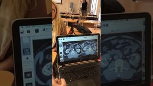 Субтракция на Osirix или Horos: часть 2 - для КТ и что такое ресемплинг