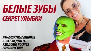 Белые зубы. Композитные виниры