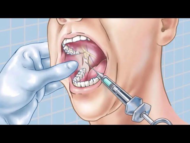 ЭЛЕКТРОННЫЙ ШПРИЦ! Вау Эффект ОБЕСПЕЧЕН! смотреть онлайн