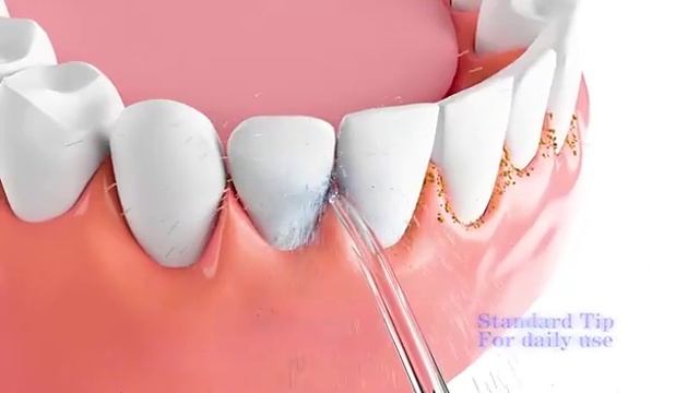 Achieve Perfect Oral Hygiene with the Seago Oral Dental Irrigator! смотреть онлайн