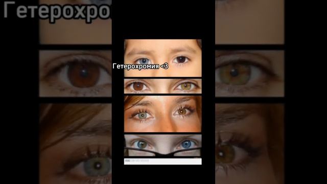 да я хочу себе разные глаза ☹️ смотреть онлайн