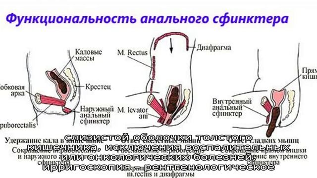 Порно Трахают В Прямую Кишку