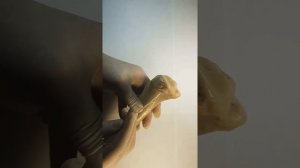 анатомия#кости голени#большеберцовая кость#