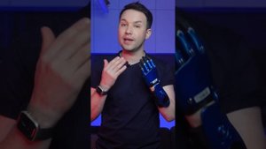 Получение протеза руки в Моторике