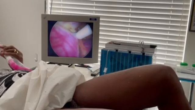 Full Rezum Procedure смотреть онлайн