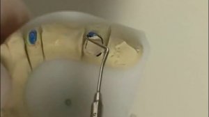 Штифтовый зуб