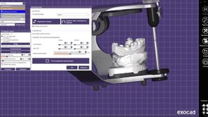 Гипсовка в виртуальный артикулятор с помощью функции "позиция скана"