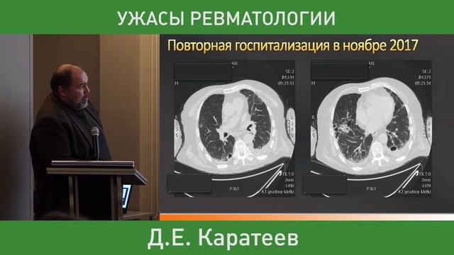 4_"Реалии практической региональной ревматологии" Д.Е. Каратеев смотреть онлайн