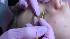 Вельвет ресниц (Velvet for lashes) - система реконструкции ресниц