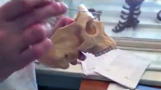 Череп в целом (кости) часть 2 смотреть онлайн