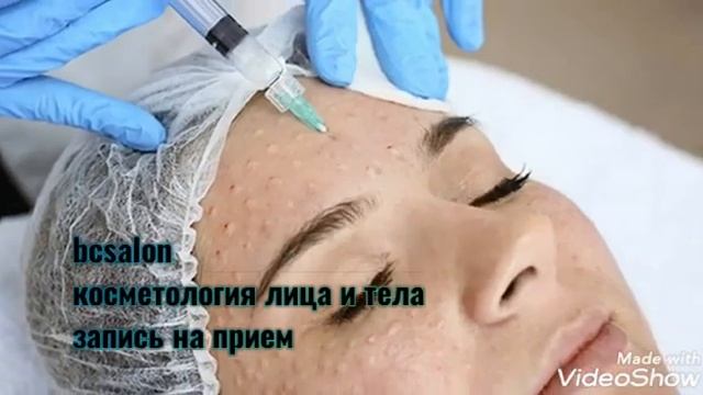 Омоложение кожи| Москва