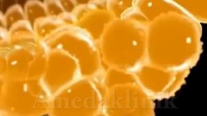 Аденома простаты. Доброкачественная гиперплазия предстательной железы.