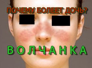 ПОЧЕМУ БОЛЕЕТ ДОЧЬ_ ВОЛЧАНКА. WHY DOES A DAUGHTER SICK_ LUPUS. KODĖL dukra serga_