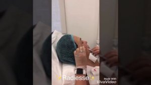 Процедура Радиесс. Филлер Радиесс в скулы. А Клиника.